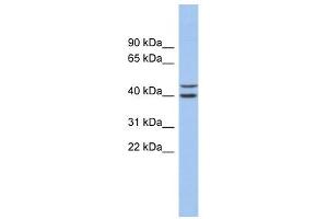 FBXL14 antibody used at 1 ug/ml to detect target protein. (FBXL14 Antikörper  (N-Term))