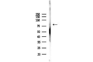 anti-Midline 1 (MID1) (N-Term) antibody