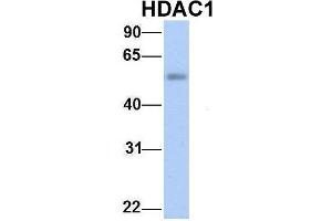Host:  Rabbit  Target Name:  HDAC1  Sample Type:  Human Fetal Lung  Antibody Dilution:  1. (HDAC1 Antikörper  (Middle Region))