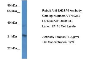 Western Blotting (WB) image for anti-SH3-Domain Binding Protein 5 (SH3BP5) (N-Term) antibody (ABIN2788423) (SH3BP5 Antikörper  (N-Term))