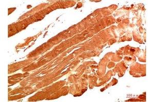 Immunohistochemical analysis of paraffin-embedded Human Skeletal Muscle Tissue using NBR1 Mouse mAb diluted at 1:200. (NBR1 Antikörper)