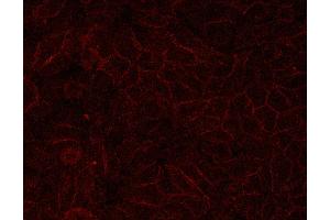E-cadherin for IHC in human HepG2,Provided by Tianjin University (E-cadherin Antikörper  (C-Term))