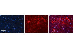 Rabbit Anti-ACP1 Antibody   Formalin Fixed Paraffin Embedded Tissue: Human heart Tissue Observed Staining: Extracellular Primary Antibody Concentration: N/A Other Working Concentrations: 1:600 Secondary Antibody: Donkey anti-Rabbit-Cy3 Secondary Antibody Concentration: 1:200 Magnification: 20X Exposure Time: 0.