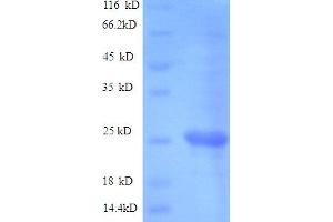VacA (AA 37-245), (partial) protein (His tag)