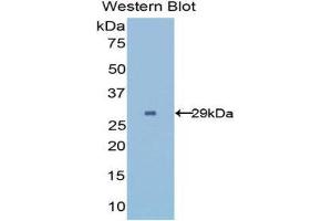 UGCGL2 antibody  (AA 1221-1408)