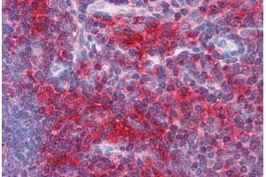 Immunohistochemistry (Formalin-fixed Paraffin-embedded Sections) (IHC (fp)) image for anti-ADAM Metallopeptidase with thrombospondin Type 1 Motif, 17 (ADAMTS17) (AA 543-651) antibody (ABIN574473)