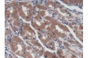 Detection of UCP2 in Human Stomach Tissue using Monoclonal Antibody to Mitochondrial Uncoupling Protein 2 (UCP2) (UCP2 Antikörper  (AA 154-289))