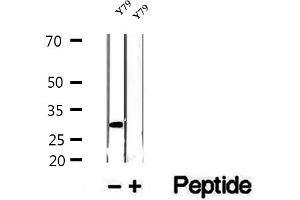 Western blot analysis of extracts of Y79 cells, using ETFA antibody. (ETFA Antikörper  (Internal Region))