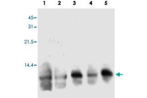 Western blot analysis of human S100A3 in hair extracts from 3 individual female. (S100A3 Antikörper)