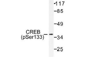 Image no. 1 for anti-cAMP Responsive Element Binding Protein 1 (CREB1) (pSer133) antibody (ABIN318001) (CREB1 Antikörper  (pSer133))