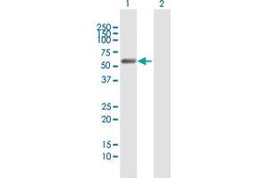 Western Blot analysis of C9orf156 expression in transfected 293T cell line by C9orf156 MaxPab polyclonal antibody.