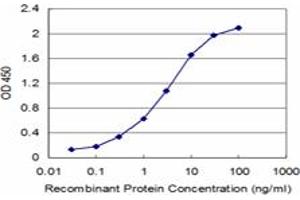 Detection limit for recombinant GST tagged CBS is approximately 0. (CBS Antikörper  (AA 1-100))