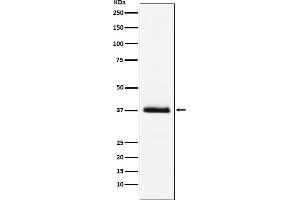 Western blot analysis of Parathyroid Hormone expression in human Parathyroid Hormone recombinant protein.