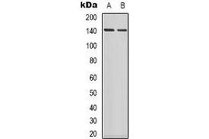 Western blot analysis of MYPT1 expression in Jurkat (A), SHSY5Y (B), COLO205 (C) whole cell lysates. (PPP1R12A Antikörper)