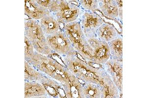 Immunohistochemistry of paraffin-embedded rat kidney using Folate Binding Protein(FBP) / FOLR1 Rabbit mAb (ABIN7267223) at dilution of 1:100 (40x lens).