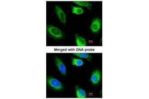ICC/IF Image Immunofluorescence analysis of paraformaldehyde-fixed HeLa, using glycerol kinase 2, antibody at 1:200 dilution. (GK2 Antikörper)