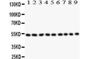 Western Blotting (WB) image for anti-Desmin (DES) (AA 1-304) antibody (ABIN3043265)