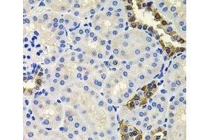 Immunohistochemistry of paraffin-embedded Mouse kidney using CALB2 Polyclonal Antibody at dilution of 1:100 (40x lens). (Calretinin Antikörper)