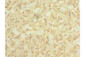 Immunohistochemistry of paraffin-embedded human adrenal gland tissue using ABIN7150185 at dilution of 1: 100 (MCM9 Antikörper  (AA 1-391))