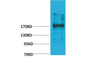 Western Blotting (WB) image for anti-Ectopic P-Granules Autophagy Protein 5 Homolog (EPG5) antibody (ABIN3181525) (EPG5 Antikörper)