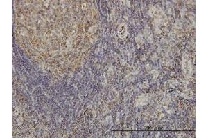 Image no. 2 for anti-Cyclin-Dependent Kinase-Like 4 (CDKL4) (AA 196-295) antibody (ABIN599344) (CDKL4 Antikörper  (AA 196-295))