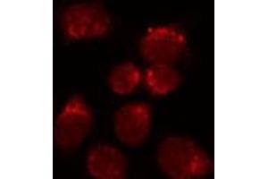ABIN6272248 staining HuvEc by IF/ICC. (NR2F2 Antikörper  (N-Term))
