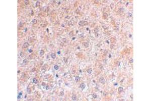 Immunohistochemical staining of mouse liver using TP53INP1 polyclonal antibody  at 2 ug/mL . (TP53INP1 Antikörper  (C-Term))