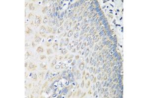Immunohistochemistry of paraffin-embedded human esophagus using OXCT1 antibody at dilution of 1:100 (40x lens). (OXCT1 Antikörper)
