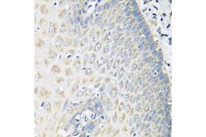 Immunohistochemistry of paraffin-embedded human esophagus using OXCT1 antibody at dilution of 1:100 (40x lens).