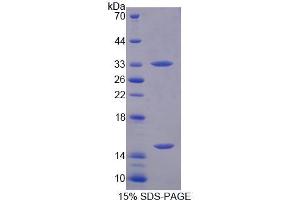 SDS-PAGE analysis of Human PGM3 Protein.