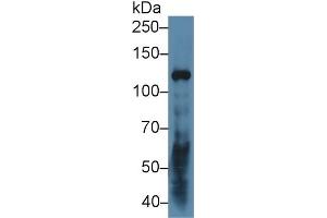 Detection of LAMC2 in Human A431 cell lysate using Polyclonal Antibody to Laminin Gamma 2 (LAMC2) (LAMC2 Antikörper  (AA 28-196))