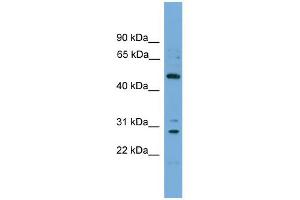 WB Suggested Anti-ULK3 Antibody Titration: 0. (ULK3 Antikörper  (Middle Region))