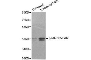Western blot analysis of extracts from 293 cells, using Phospho-MAPK3-T202 antibody. (ERK1 Antikörper  (pThr185))