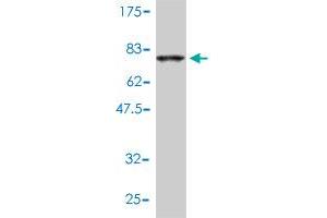Western Blotting (WB) image for anti-Collagen, Type VI, alpha 2 (COL6A2) (AA 1-425) antibody (ABIN560427)