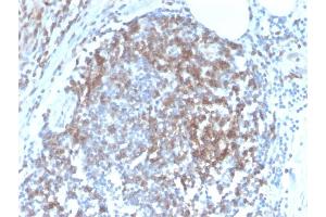 Formalin-fixed, paraffin-embedded human Tonsil stained with CD6 Rabbit Recombinant Monoclonal Antibody (C6/2884R). (Rekombinanter CD6 Antikörper)