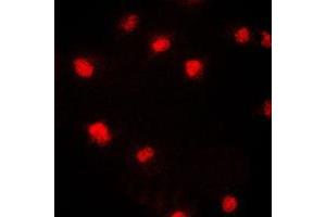 Immunofluorescent analysis of CDC46 staining in HeLa cells. (MCM5 Antikörper  (N-Term))