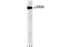 Western blot analysis of CD29 (Integrin beta1) on a A431 cell lysate (Human epithelial carcinoma, ATCC CRL-1555). (ITGB1 Antikörper  (AA 76-256))