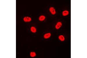 Immunofluorescent analysis of SP3/4 staining in HeLa cells. (Sp3/4 Antikörper  (C-Term))