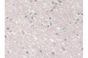 Immunohistochemistry (IHC) image for anti-Glutathione Peroxidase 3 (Plasma) (GPX3) (AA 21-72) antibody (ABIN7435298)