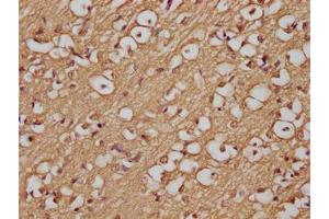 Immunohistochemistry of paraffin-embedded human brain tissue using ABIN7144489 at dilution of 1:200 (APP Antikörper)