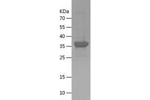 Western Blotting (WB) image for CTF18, Chromosome Transmission Fidelity Factor 18 Homolog (CHTF18) (AA 71-301) protein (His-IF2DI Tag) (ABIN7283744) (CTF18 Protein (AA 71-301) (His-IF2DI Tag))