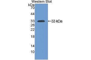 Western blot analysis of recombinant Rat SIRT2. (SIRT2 Antikörper  (AA 28-303))