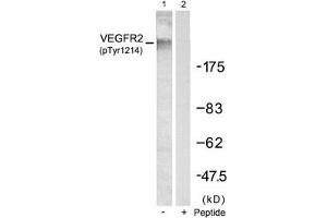 Western blot analysis of extracts from SKOV3 cells using VEGFR2(Phospho-Tyr1214) Antibody(Lane 1) and the same antibody preincubated with blocking peptide(Lane2). (VEGFR2/CD309 Antikörper  (pTyr1214))