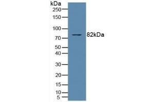 Detection of PKCq in Human Jurkat Cells using Polyclonal Antibody to Protein Kinase C Theta (PKCq) (PKC theta Antikörper  (AA 380-634))