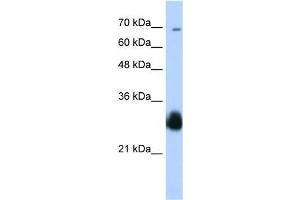 Transfected 293T; WB Suggested Anti-RNF138 Antibody Titration: 0. (RNF138 Antikörper  (C-Term))