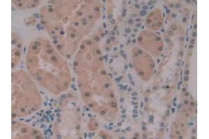 Figure. (PKIB Antikörper  (AA 8-76))