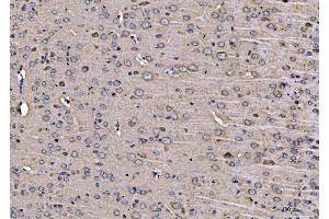 IHC analysis of ARFGAP1 using anti-ARFGAP1 antibody (ABIN4886474).