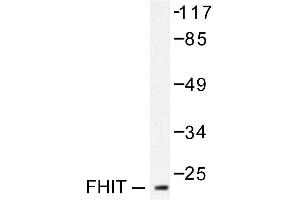 Image no. 2 for anti-Fragile Histidine Triad (FHIT) antibody (ABIN265419) (FHIT Antikörper)
