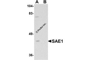 Western Blotting (WB) image for anti-SUMO1 Activating Enzyme Subunit 1 (SAE1) (C-Term) antibody (ABIN1030635) (SAE1 Antikörper  (C-Term))