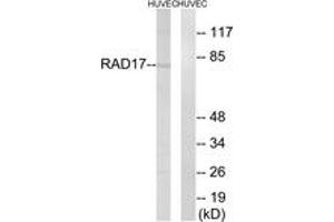 Western blot analysis of extracts from HuvEc cells, using RAD17 (Ab-645) Antibody.